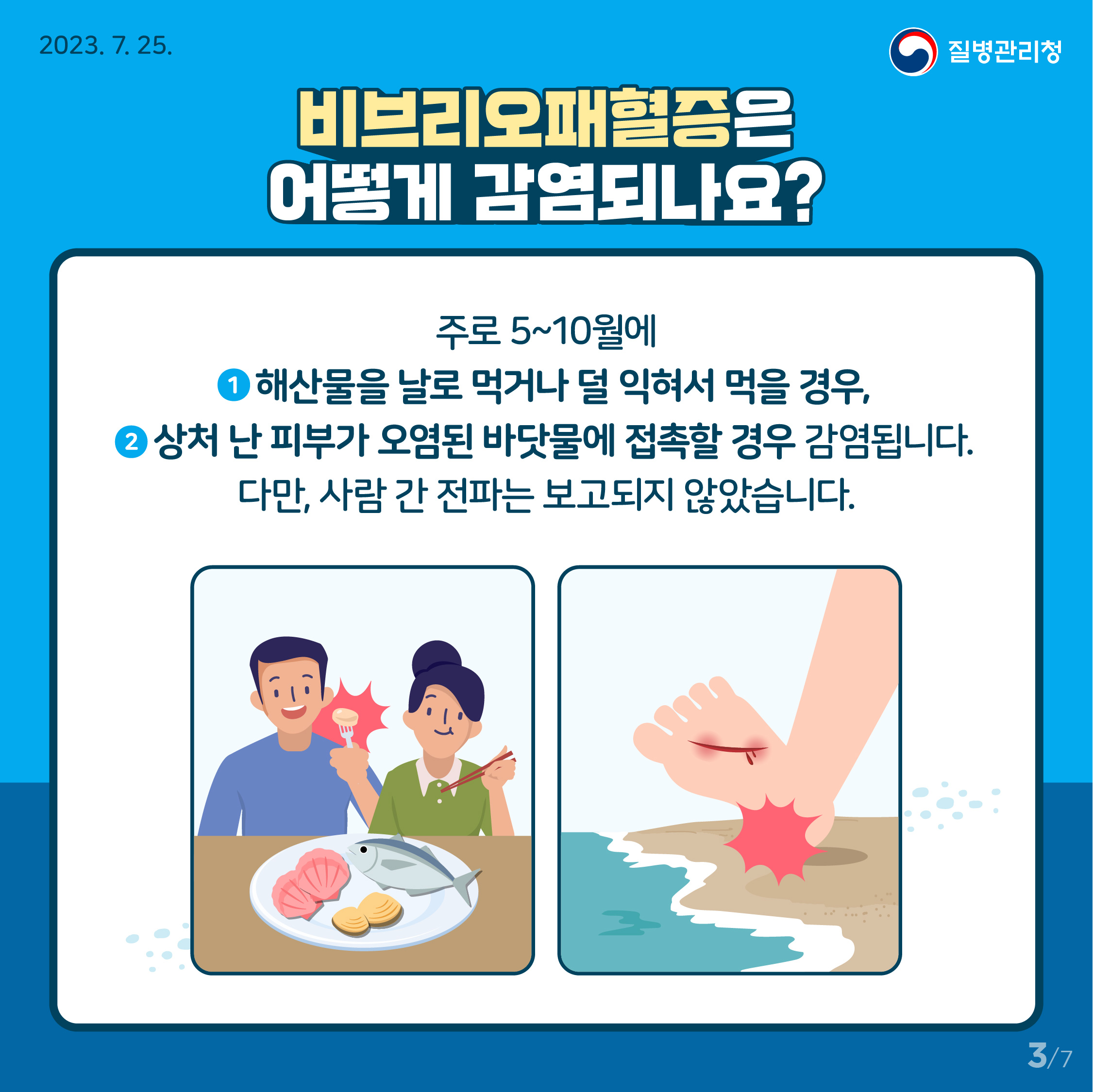 여름철 수인성·식품매개감염병 중 비브리오패혈증 예방수칙 이미지 3