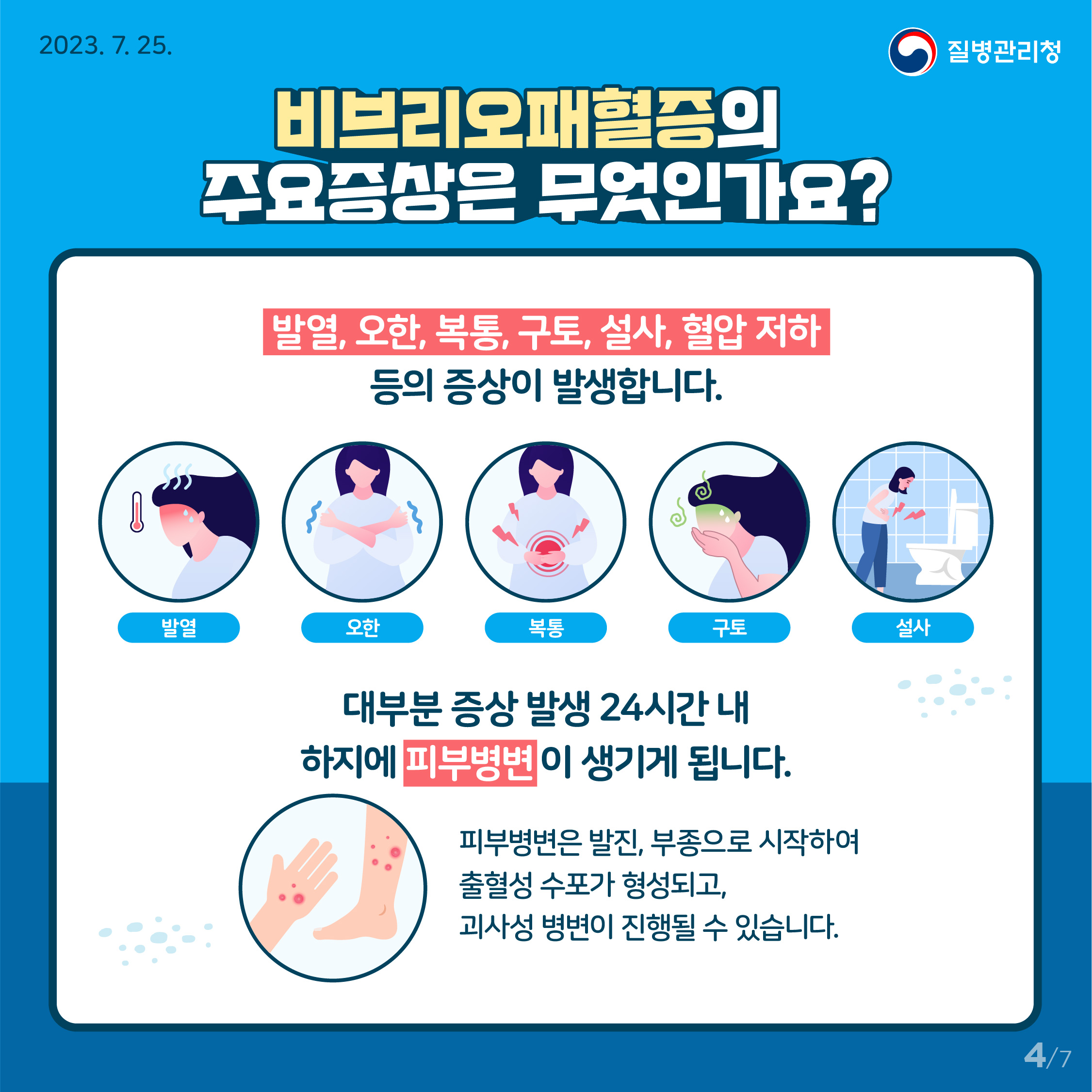여름철 수인성·식품매개감염병 중 비브리오패혈증 예방수칙 이미지 4